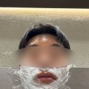 스노우의원 | 수염 레이저 제모 병원 선택 주저리주저리, 1회차 제모 간단 후기(울산 스노우의원 내돈내산)