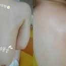 아토제제 이미지