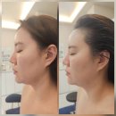 본죽 증심사입구역점 | [광주학동피부관리] 아레떼뷰티랩, 기노 제품으로 완성한 1:1 맞춤 정밀 케어 찐 후기