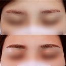 디자인플러스 | 여자 눈썹반영구 문신 자연커버 후기, 디자인뷰티플러스 양재역점