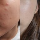 11545-08-00-55 | <초특가마감!!> 스팟 컨트롤 크림 1개 혹은 10개 set!!