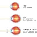 드림아이 이미지