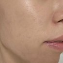 엔디피(NDP) 이미지