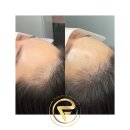 가비헤어 이미지