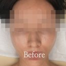 3834 | 수원윤곽관리 잘하는곳, 수봄에스테틱에서 예신 맞춤 라인 케어 받고 온 후기(비포/애프터 사진 O)