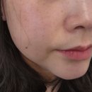 아쿠아산소사우나 | 🔥피부관리부터 윤곽까지 싹! 라플러스에스떼 아쿠아필+하이푸+산소발생기 체험 후기