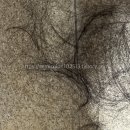 SP-5D03 | [유방암기록] D +124. 항암 후기➂ - 1차의 기록들 : 머리, 꼭 밀어야 할까?