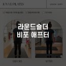 다산정비 | 다산역 필라테스 라운드숄더 Before &amp; After 후기