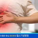 췌장암 오른쪽 왼쪽 등 통증 원인 위치 이미지