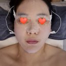 글로윈 | [글로위스킨]대전 관평동 에스테틱 극초단파 리프팅/윤곽관리 후기