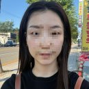루미온다