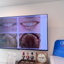 오장균치과교정과치과의원 | 마석교정치과 치아나라 치과교정과 치과의원 후기 대만족이에요!