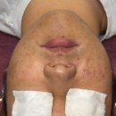 노산서18길 | [창원/마산]남자 화농성 여드름 피부관리 6주동안 관리한 후기! (제시뷰티 에스테틱)