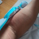 아주척마디의원 | 골프로 인한 부상 치료 평택 "아주척마디의원" 방문