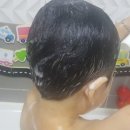 베이비스킨 이미지