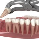 서울돌봄치과의원 이미지