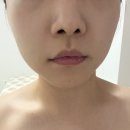 장유피부관리 아트피움에서 알테온 후기남겨요❤️