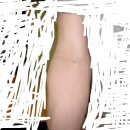 저 전완근은 두껍고 윗팔은 안두꺼운데 어떻게 살찌는방법없을까요 ㅠㅠ 이미지