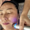 수기해변 | 다대포 피예날에스테틱｜사하구 수기관리맛집에서 받은 물방울관리 &amp; 비립종압출 후기