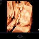 목포미즈아이병원 | [임신기록] 임신 20주차 목포미즈아이병원 정밀초음파 후기+자궁경부 짧아짐 이슈