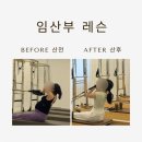 질문으로 톡톡, 글이 팡팡 | 대구 임산부 요가 10년 차 원장이 알려주는 후회 없는 선택 기준 3가지