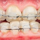 미소를만드는치과교정과치과의원 이미지