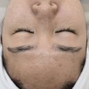 뷔에고 | 운양동피부관리 뷔에고에스테틱 윤곽재생관리 후기