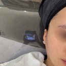 드림허브 | 온천장 [올가드림뷰티] 모공디톡스 후기