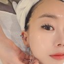의정부 피부관리 리라신 물광 탕후루 필 관리후기 스킨뮤즈