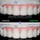 윤치과기공소 이미지