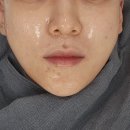 콜라당 | 과천피부과 콜라스터추천 스킨부스터 후기 내돈내산 찐!