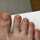 르밍네일