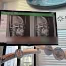 전북대학교치과병원 | 전주 교정치과 추천｜10년째 다니는 미소아름치과 정기검진 후기