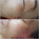 맑은피부에스테틱 - 서구 | 맑은피부에스테틱