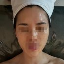 예하샵 | 주안 신부관리 데콜테포 작은얼굴 윤곽리프팅 예하 에스테틱 인천 주안점 후기