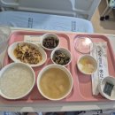 [대구 계명대 동산병원 성서] 입원후기/다발성경화증/탈수초성질환/자가면역희귀질환/미각상실/어지러움/