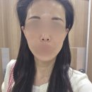 덴서티 내돈내산 통증 효과 솔직 후기
