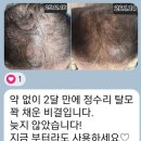 첨단기업5로1R-6 | 한방 복합 추출물과 첨단 기술의 만남 광주 AA&amp;T '해파 올인원 샴푸', 1달 사용 후기