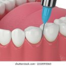 바른웅치과의원 이미지