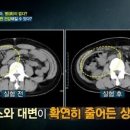 트윈스킨 이미지