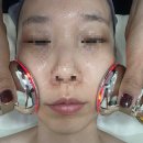 더고운피부 | 서산 고운피부에스테틱 체험후기