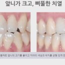 미소하나치과의원 이미지