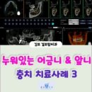 걸포탑치과의원 네이버블로그