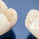 뿌리치과기공소 이미지