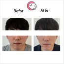 파주 운정 피부관리 깔끔하게 잘하는 금손네일 내성발톱 무좀 발각질 네일 문제성발