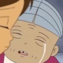 클래스원치과의원 | 돌출입교정후기로 알아보는 교정장치 종류와 교정 1-7일차!