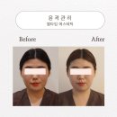 엘타임 | 구미 결혼준비 예신경락추천! 웨딩케어 후기"엘타임에스테틱"