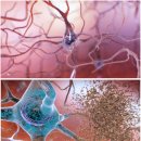 진영의료기 이미지