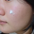 사춘기 여드름 관리를 위한 사춘기 여드름 화장품 후기