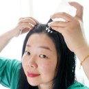 헤어박사 | 여자M자탈모 두피앰플 리필드 사이토카인 헤어토닉 2주사용 후기